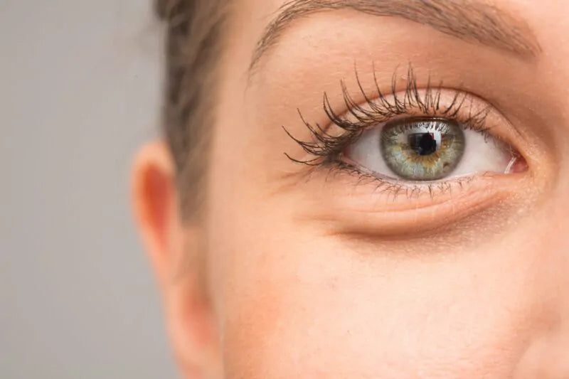 Tränensäcke: Was wirklich gegen die geschwollenen Augen hilft